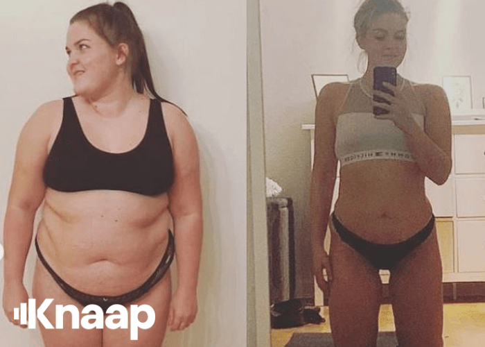 Michelle, 20 år, tabte sig 40kg fedt
