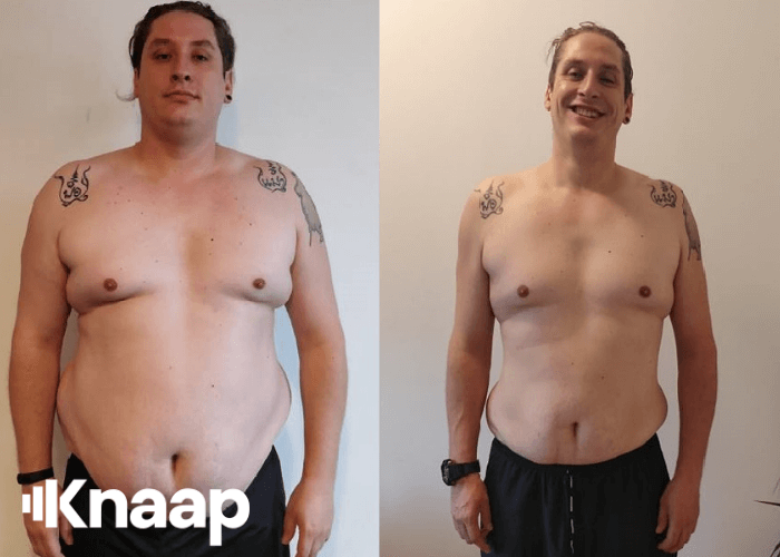 Emil, 35 år, har tabt over 30 kg fedt